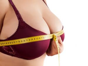 Breast-Reduction-Blog