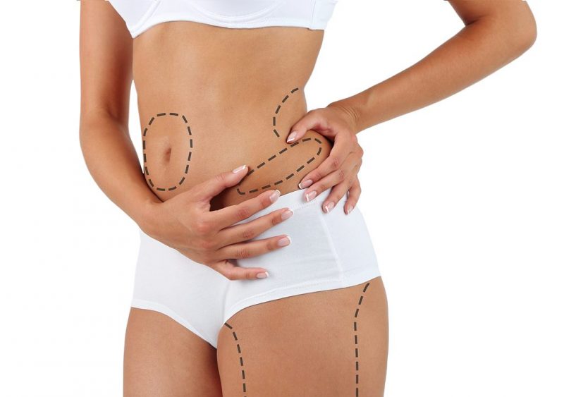 Why liposuction is nothing to be worried about