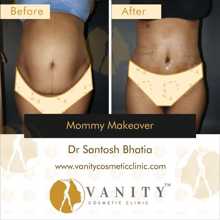 mommy-makeover-vanity-cosmetic-clinic-front-view-5