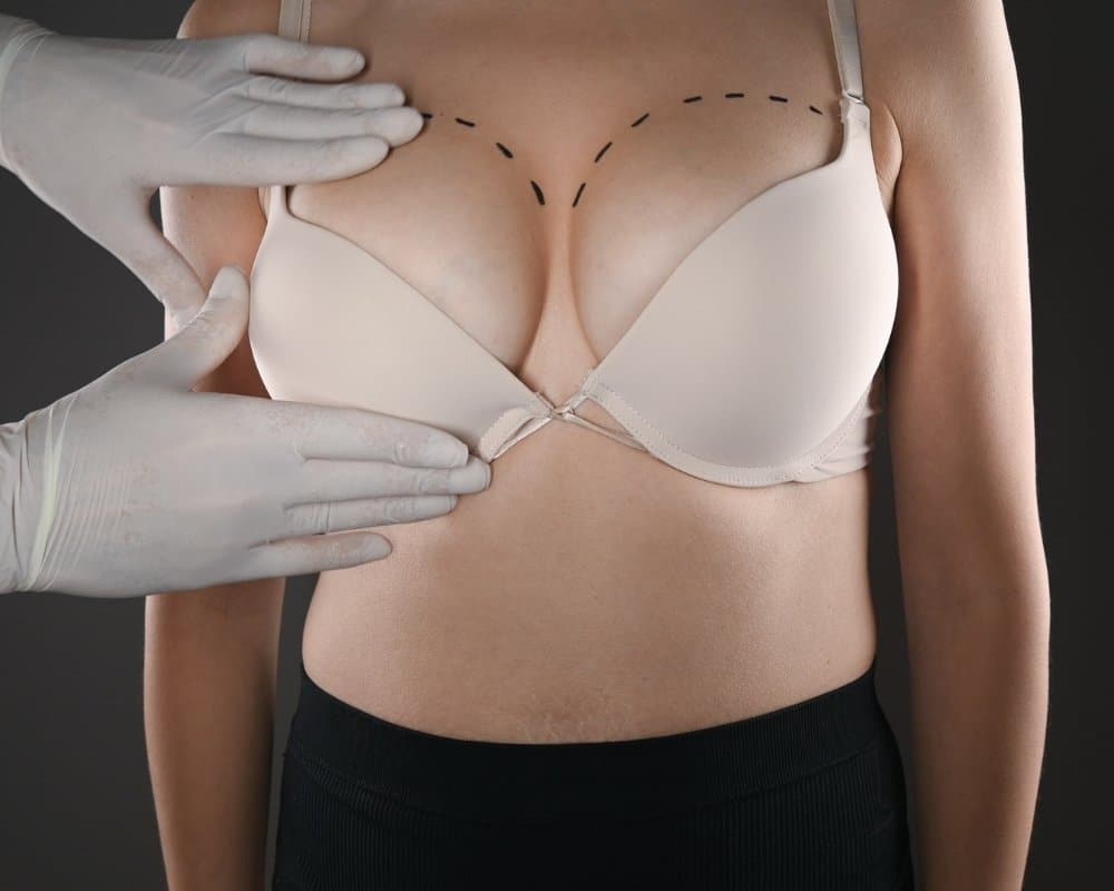 When do you need breast augmentation and a breast lift?